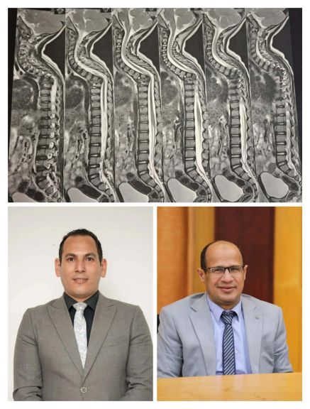 قسم جراحة العظام بأزهر أسيوط يُنهي معاناة ابن الثلاث سنوات وينتصر على التحدب